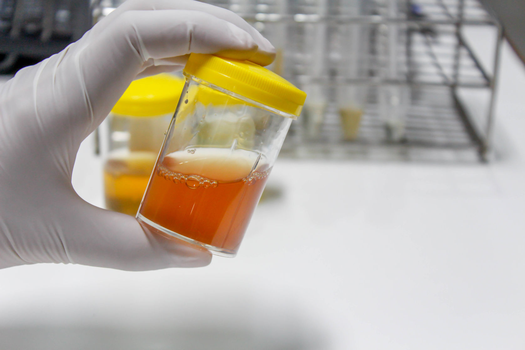 FalsePositive Urine Drug Monitoring Results and Aspirin