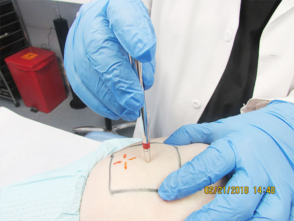 whats the benefit of b12 injections Vitamin B12 Injections Specialist in Langhorne, PA