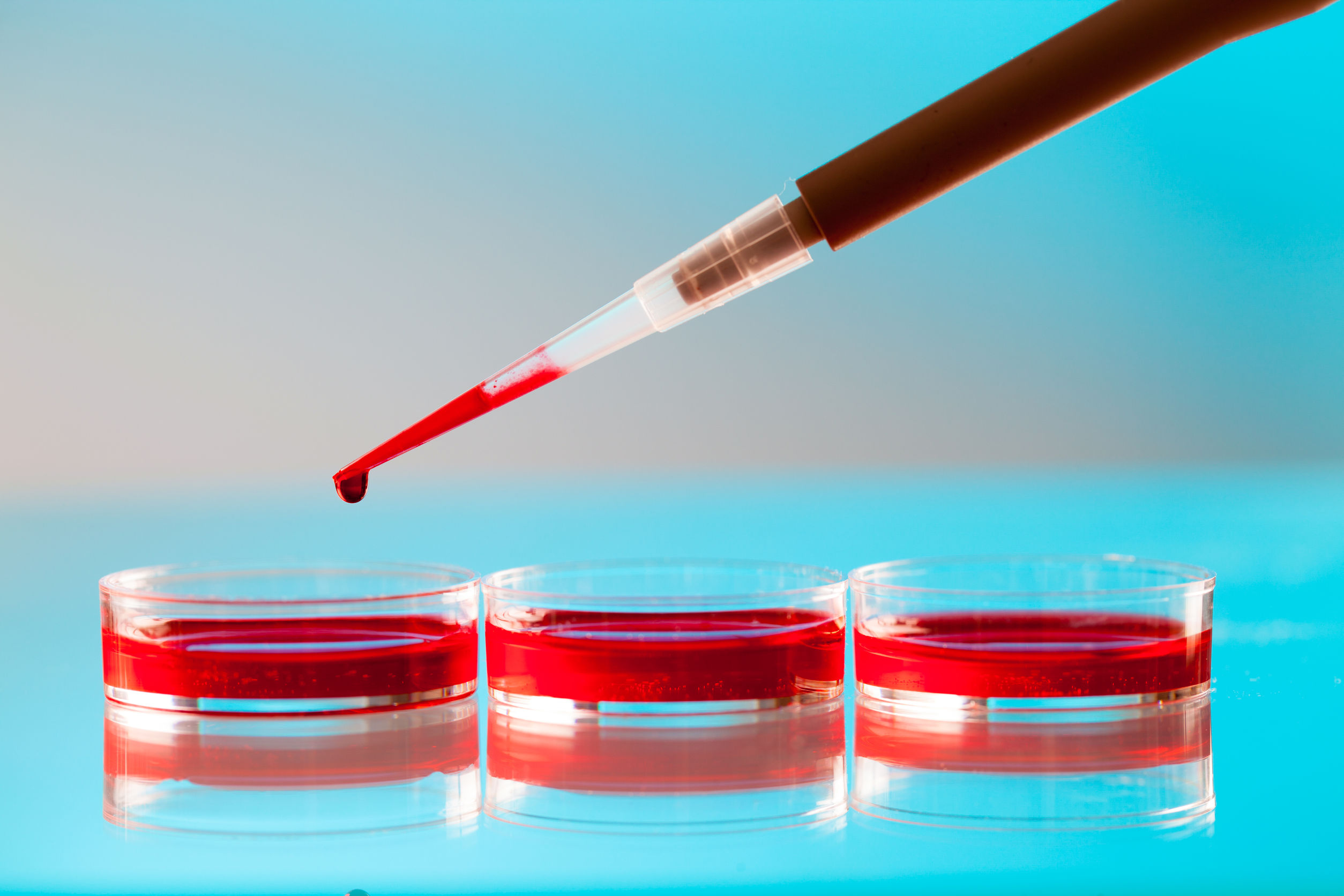 Blood Biomarkers Show Promise for Precision Pain Management