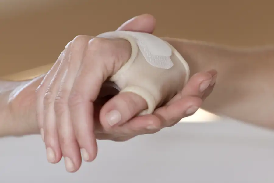 What is Carpel Tunnel Syndrome? - South Florida Orthopaedics & Sports  Medicine