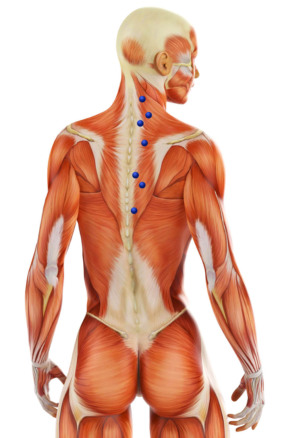 What To Know About Myofascial Pain Syndrome