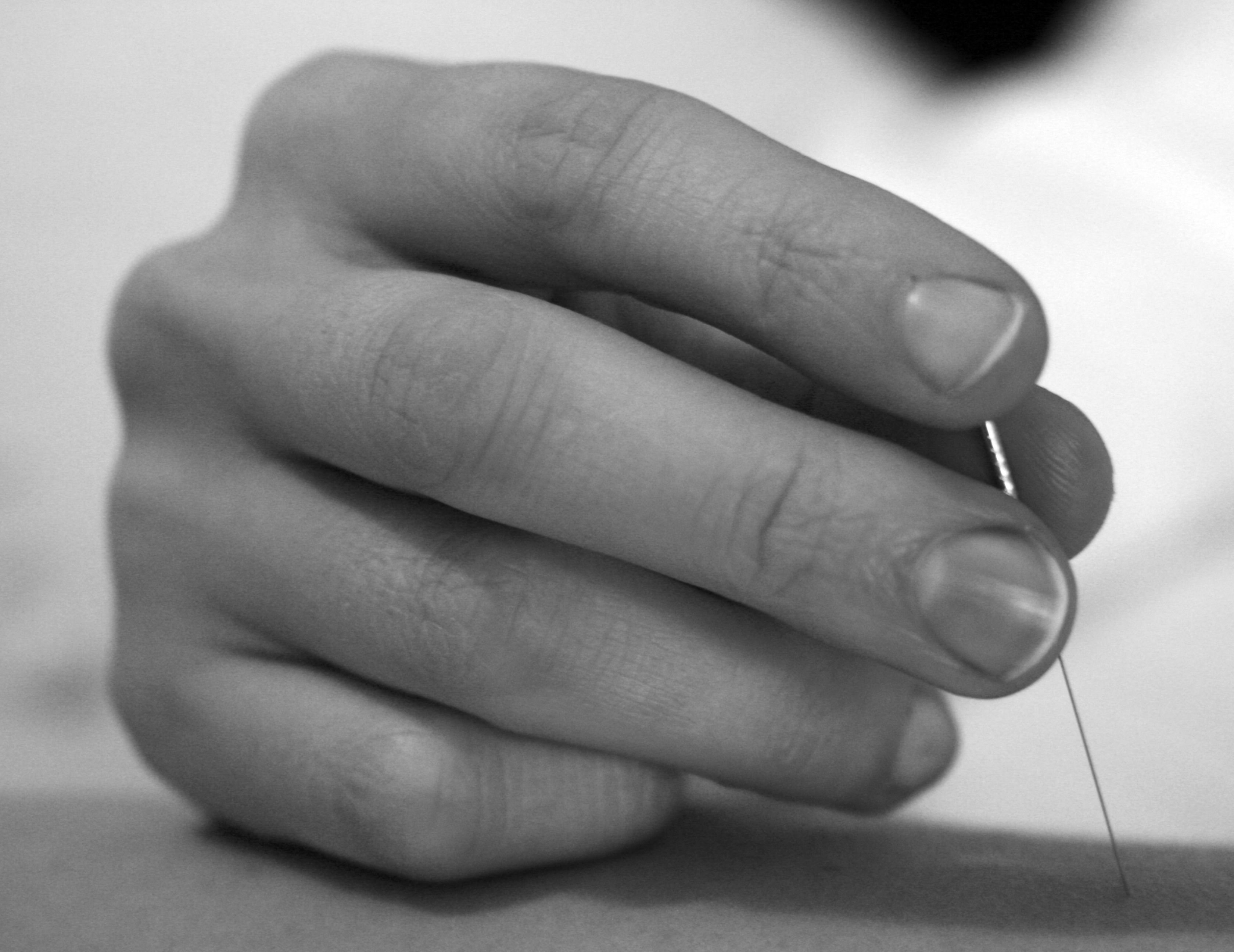 traditional-chinese-medicine-acupuncture