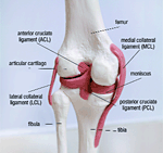 Need for More Accurate ER Diagnoses of ACL Injuries