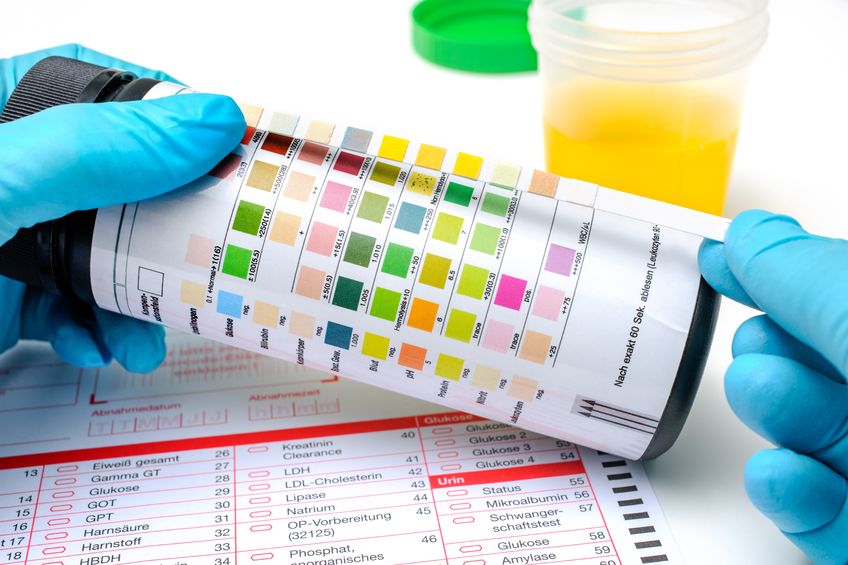 Two New Urine Drug Screens Get FDA Approval for Quick InOffice Testing