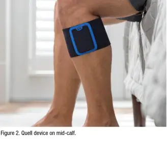 Introducing Smart Wearable Pain-Relief Device: TENS 2.0