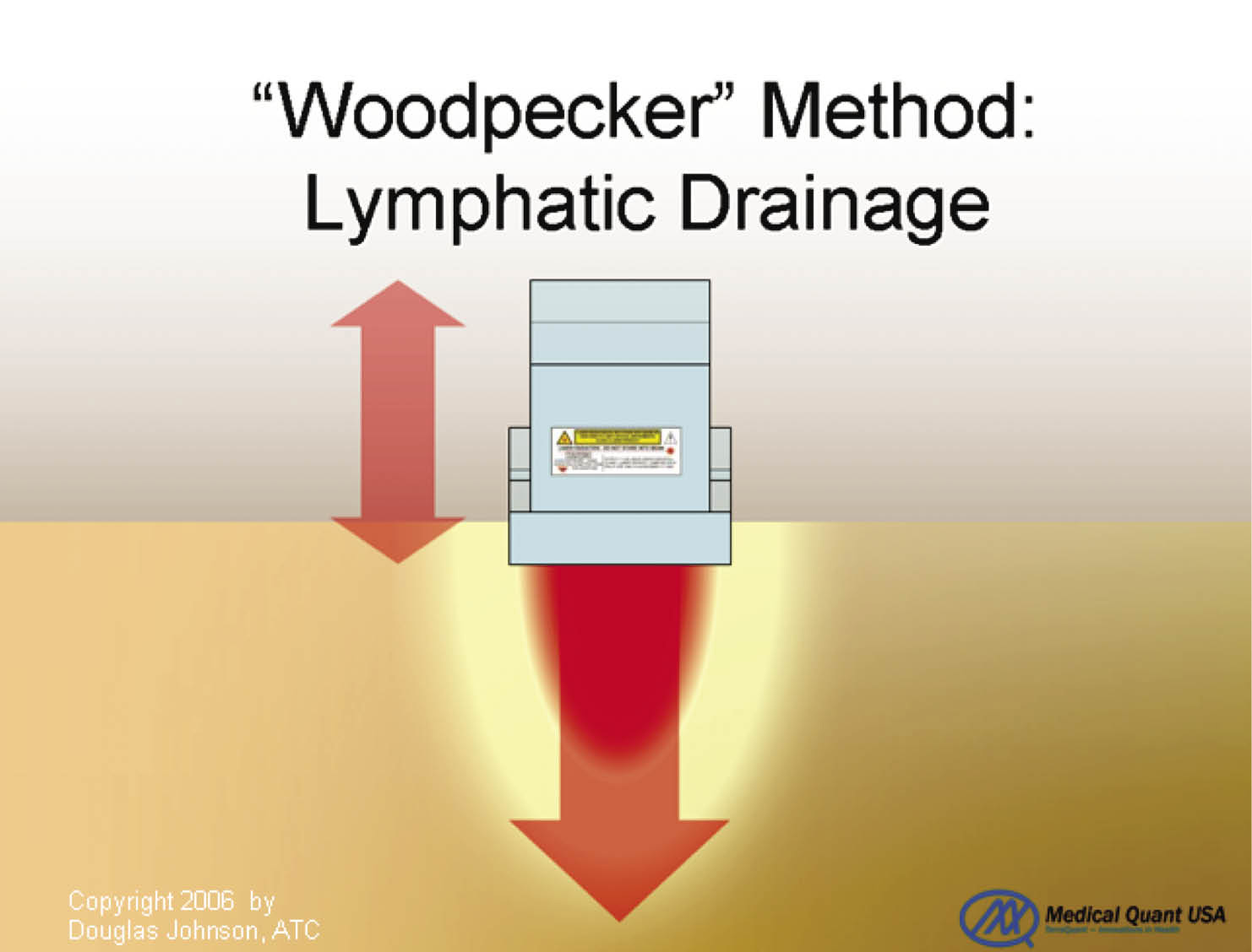 Literature Offers Little Direction on the Safety and Efficacy of Low-level  Laser Therapy for Back Pain