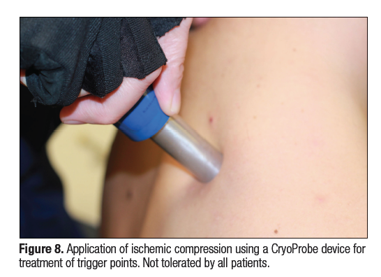 Extracorporeal Shock Wave Therapy—Application for Trigger Points