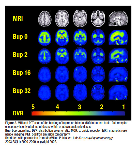 Is Buprenorphine a ‘Partial Agonist’? Preclinical and Clinical Evidence