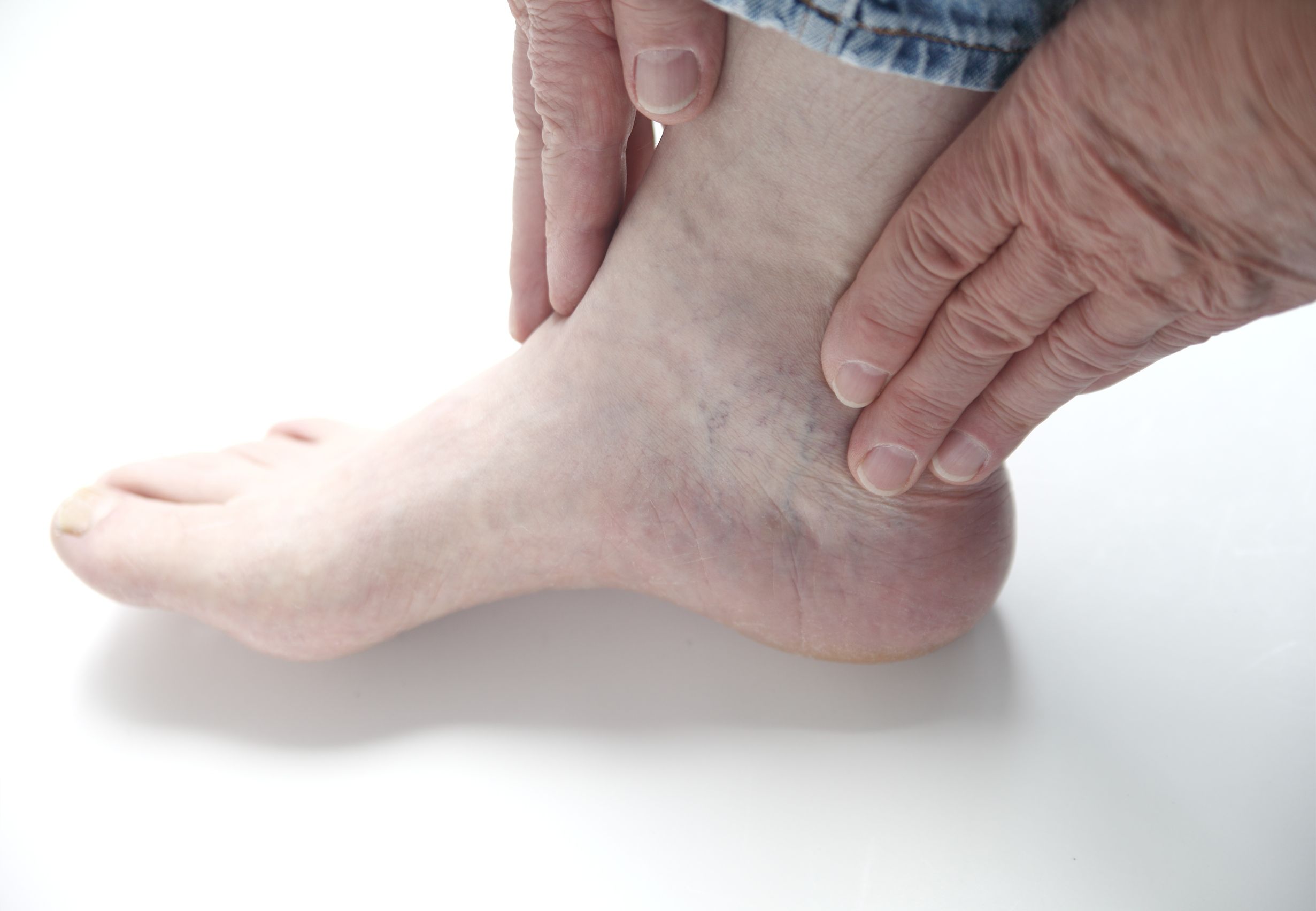 Diabetic Peripheral Neuropathy - Highlands Foot and Ankle