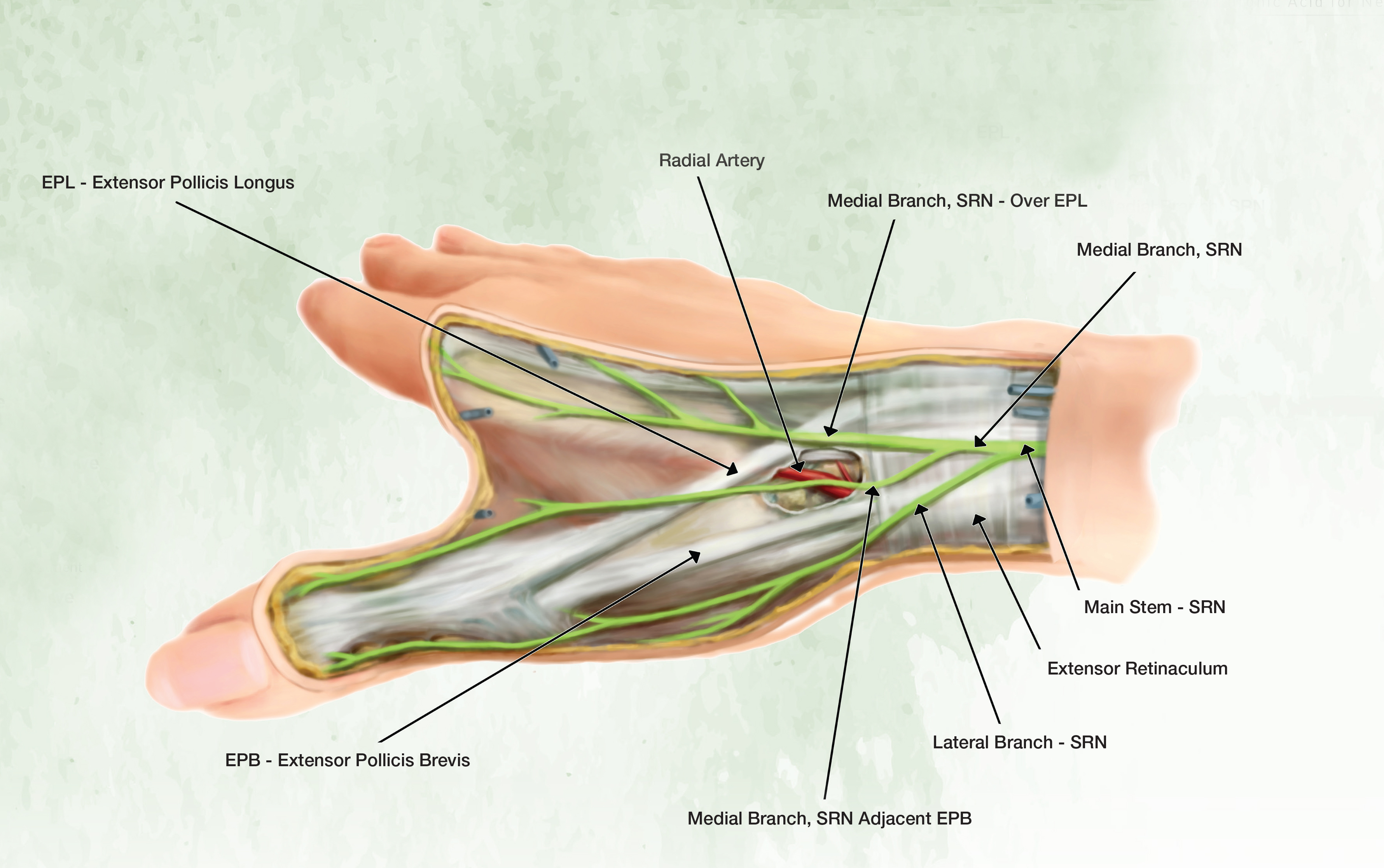 b12 and ecm injections for neuropathy Injection of Cross-Linked Hyaluronic Acid Neuropathic Pain weight loss & sports nutrition