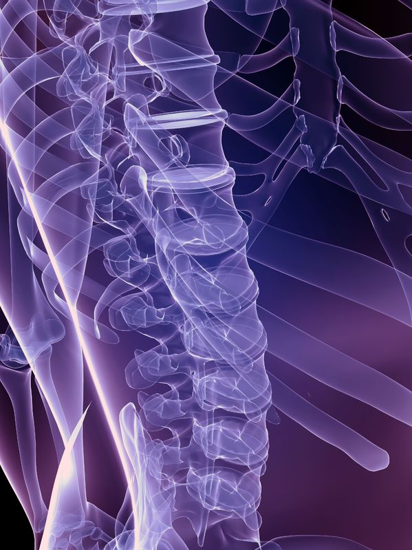 Epidural Corticosteroid Injections Indications, Risks, and