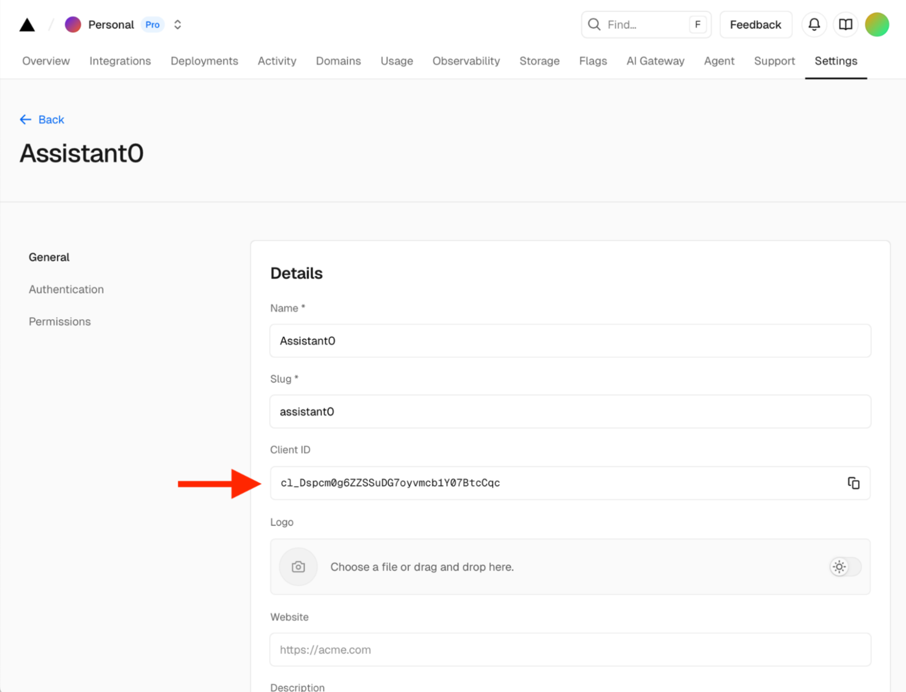 Vercel Authentication Screen