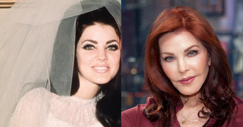 Priscilla Presley Celebrity Plastic Surgery Disasters - vrogue.co