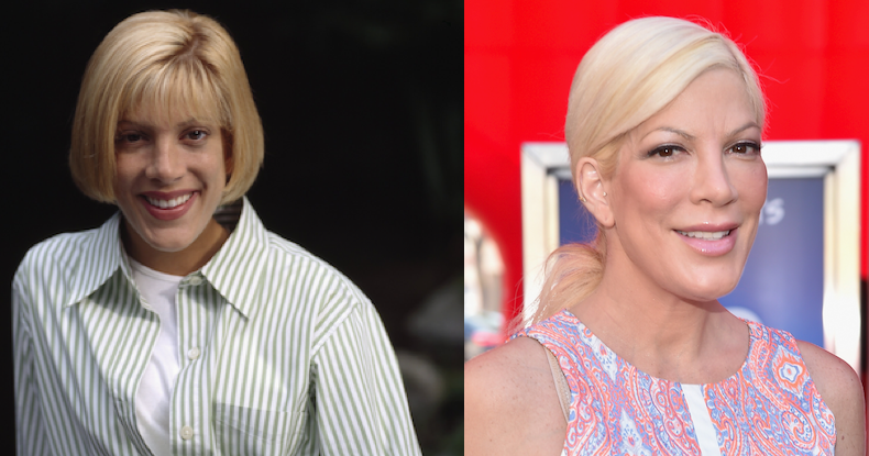 Tori Spelling | Plastic Surgery Disasters | Purple Clover