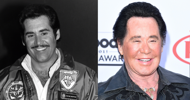 Wayne Newton | Plastic Surgery Disasters | Purple Clover