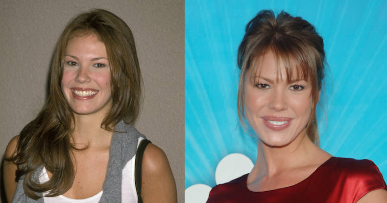 Surgery Nikki Cox