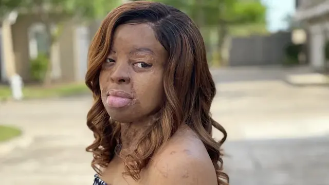 Kechi Okwuchi Talks Survival, Singing and Self-Love for Face Equality Month