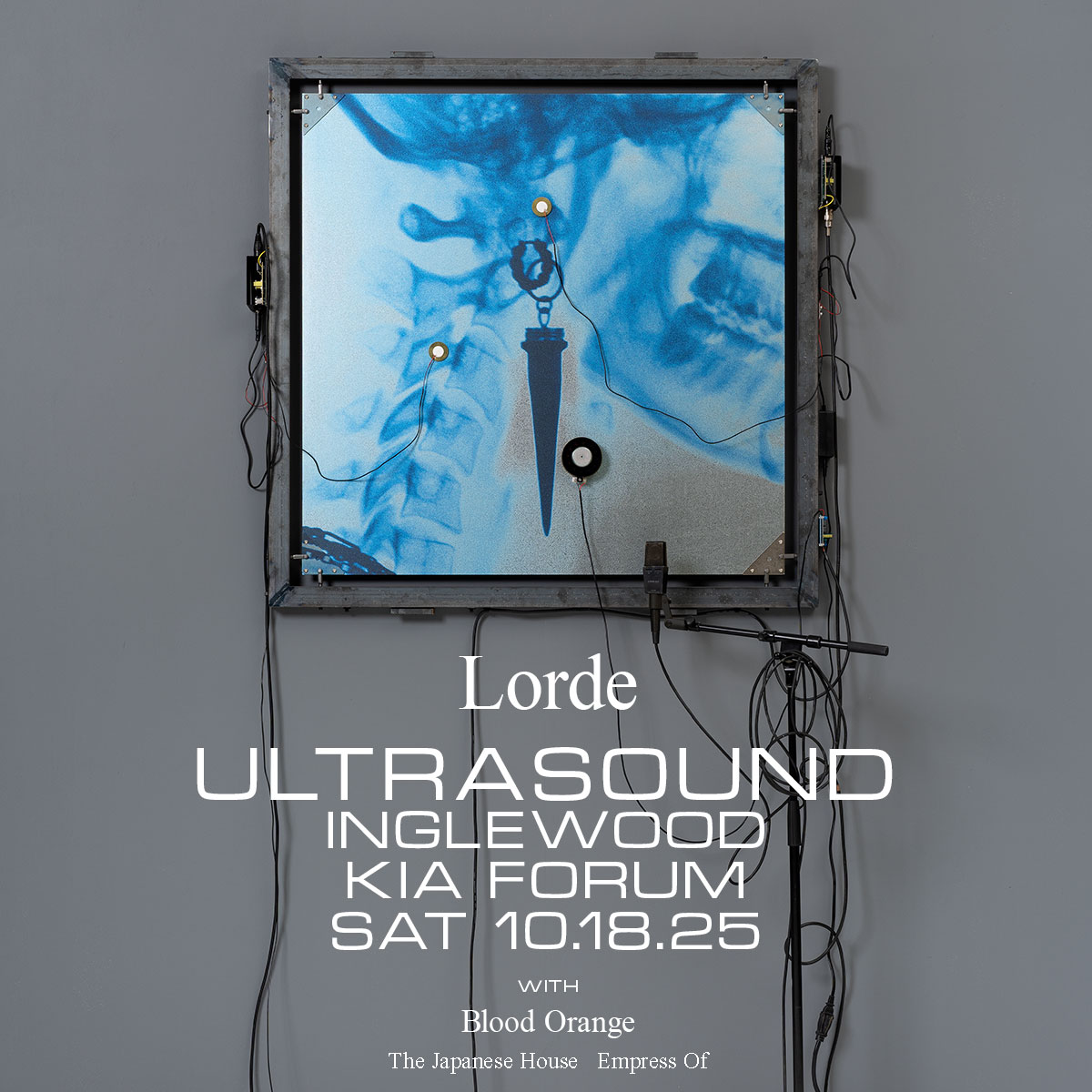 Lorde concert poster featuring blue medical ultrasound image in frame with wires, promoting Ultrasound show at Inglewood Kia Forum.