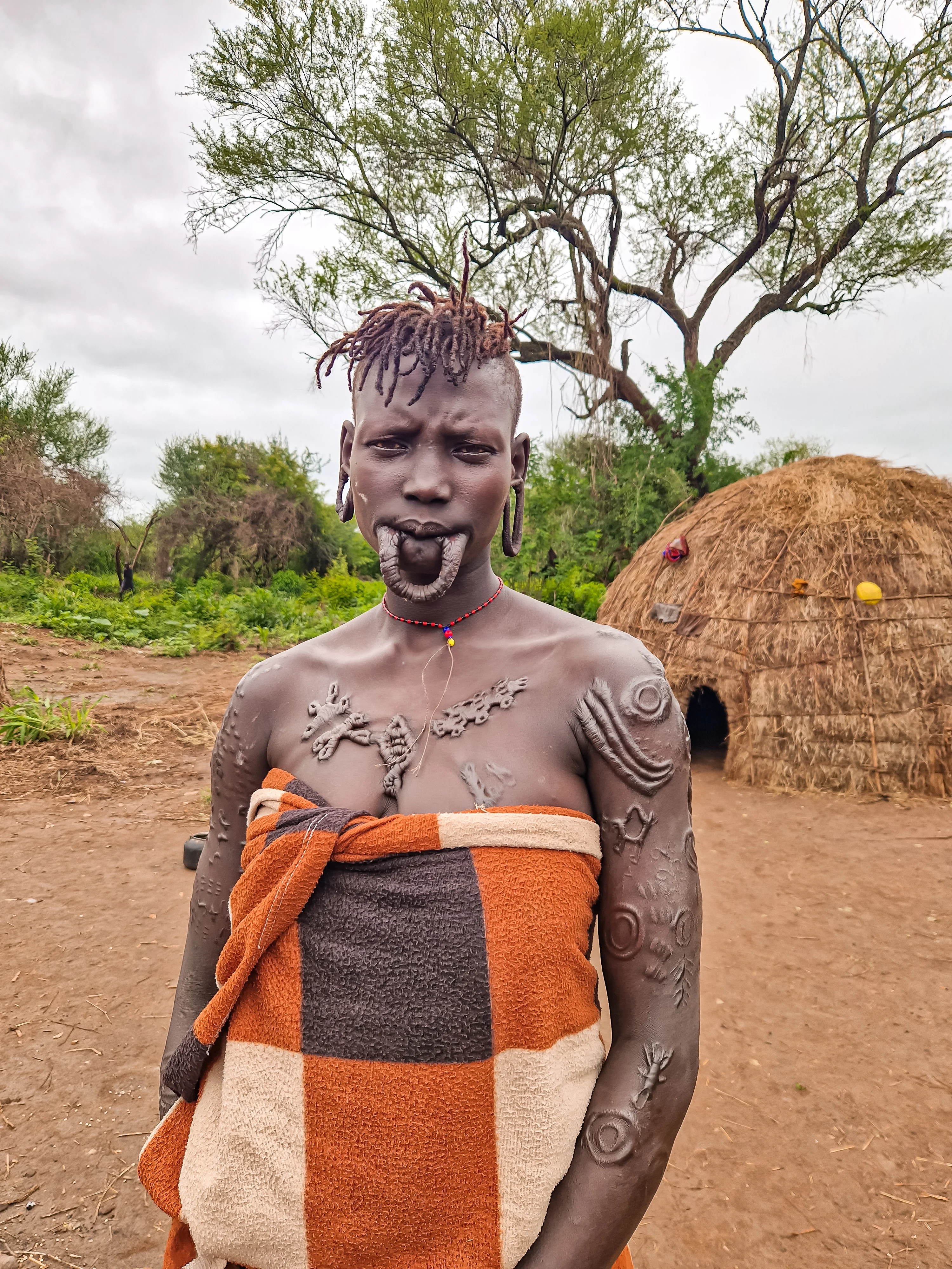 Scars and lip plate of the Mursi