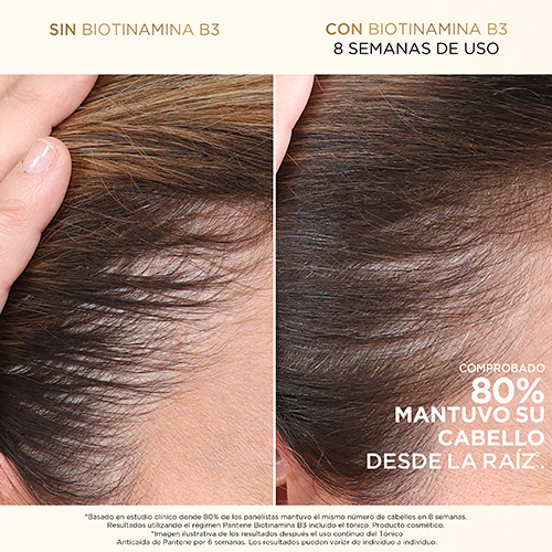 Imagen de producto: Shampoo anticaída+  con Biotinamina B3