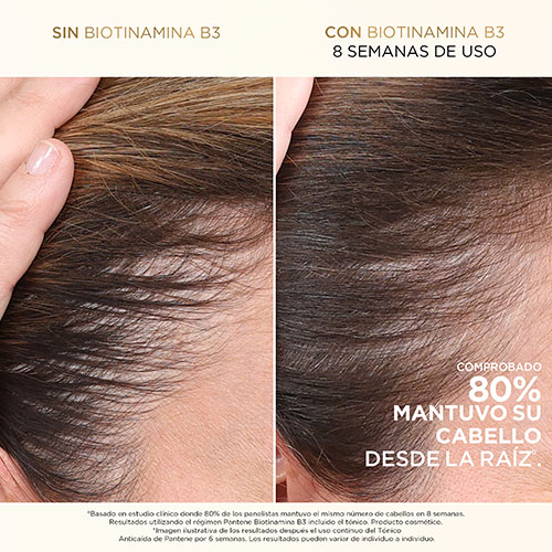 Imagen de producto: Tónico capilar anticaída + Biotinamina B3 para todo tipo de cabello
