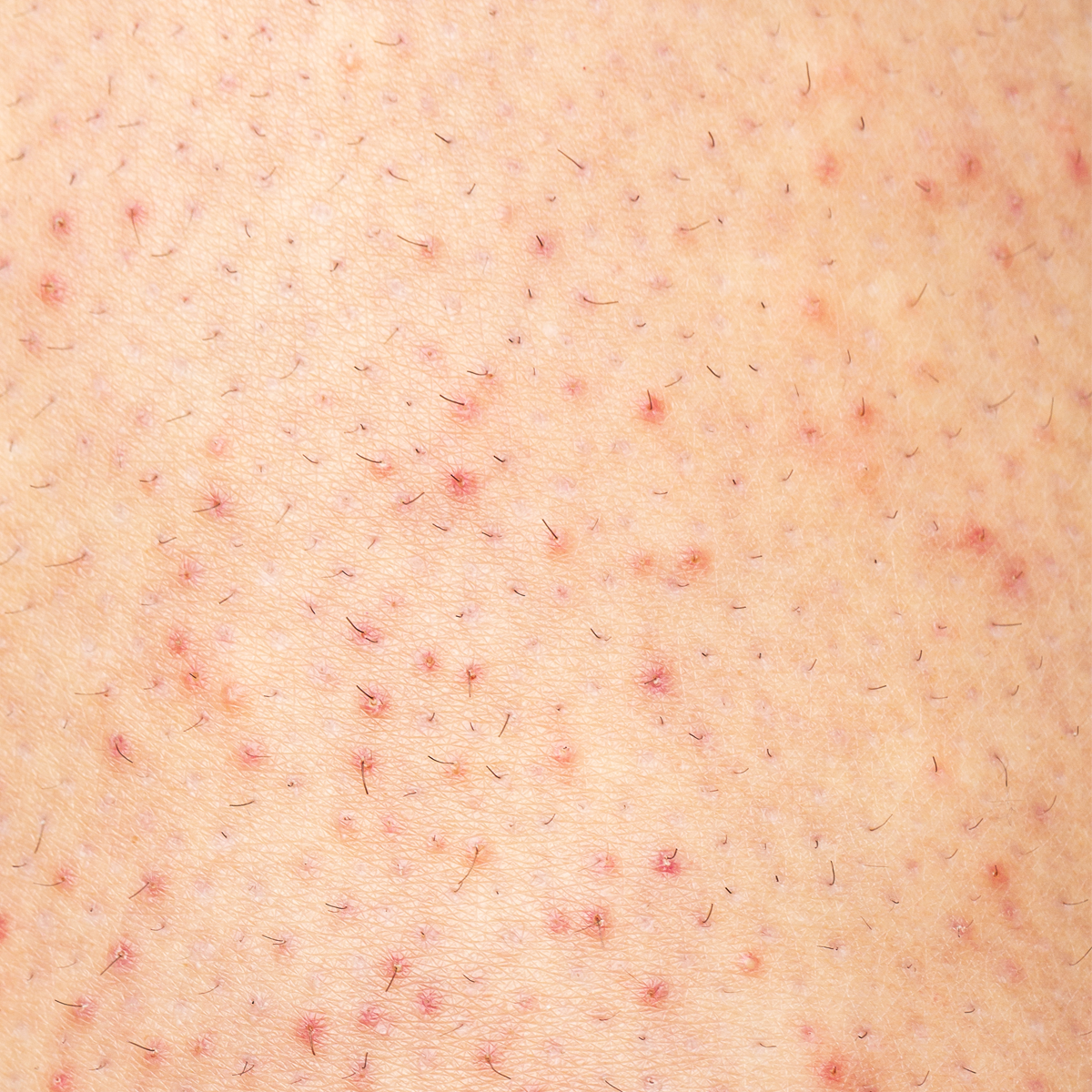 Ogil bolalarni urish jazosi video