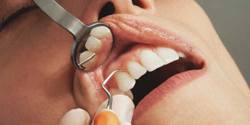 Dentálna hygiena