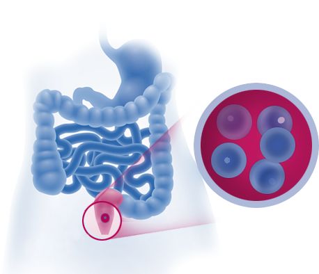 MICROLAX® auttaa pehmentämään ulosteita