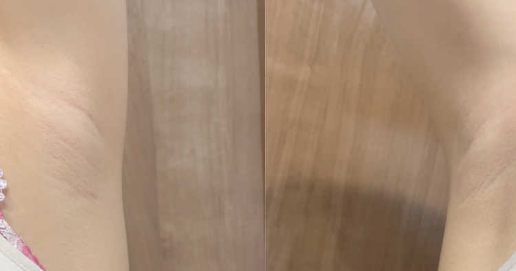 美人JDのリアルな腋をチェック