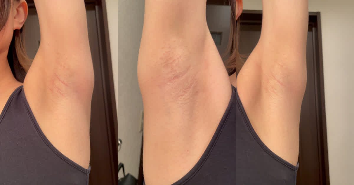 ショートカット美女の美ワキを至近距離での作品写真0