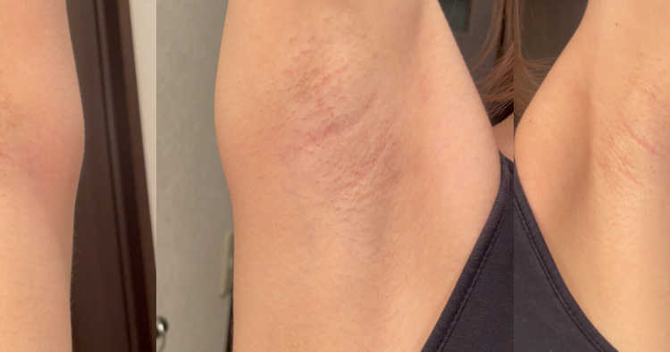 ショートカット美女の美ワキを至近距離で