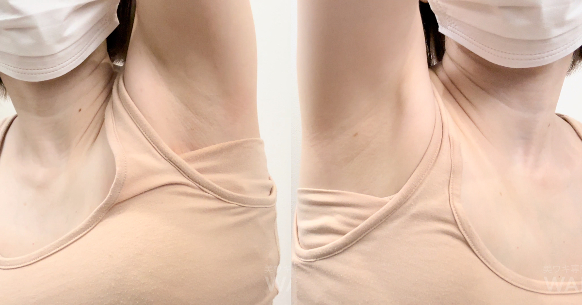 そそるOLの腋を見せてもらいました