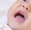 طفل مصاب بالارتجاع المريئي