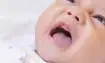طفل مصاب بالارتجاع المريئي