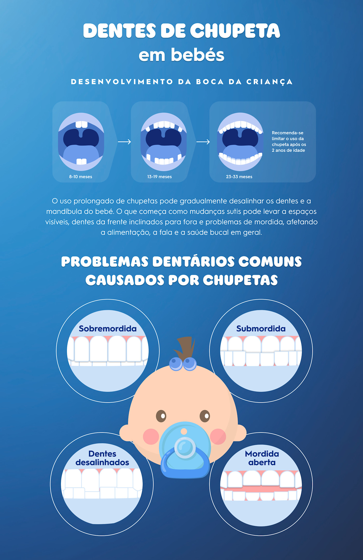 A partir de que idade é que a chupeta afeta os dentes?