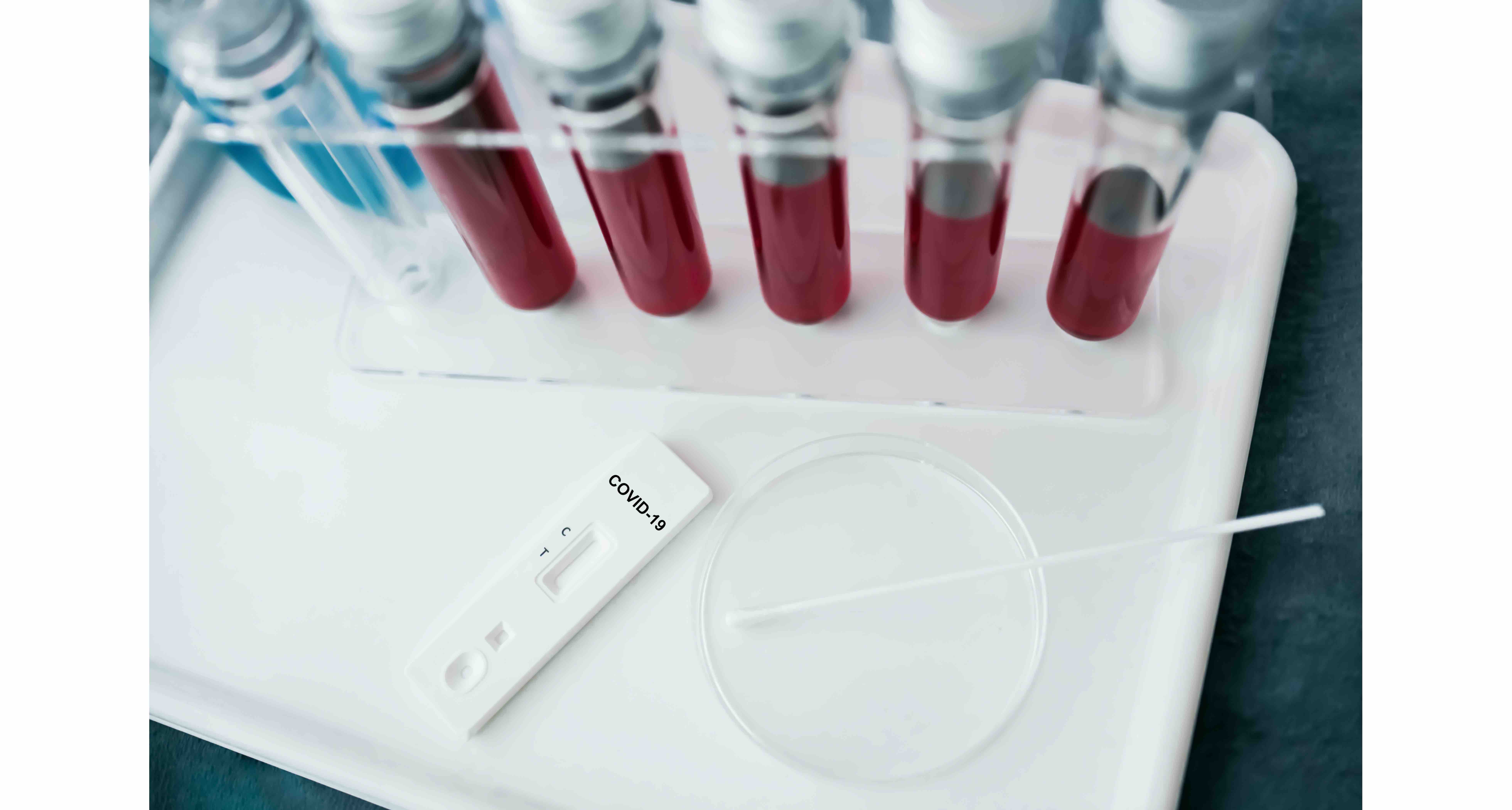 QNRF Infectious Diseases Research Webinar - corona - 02