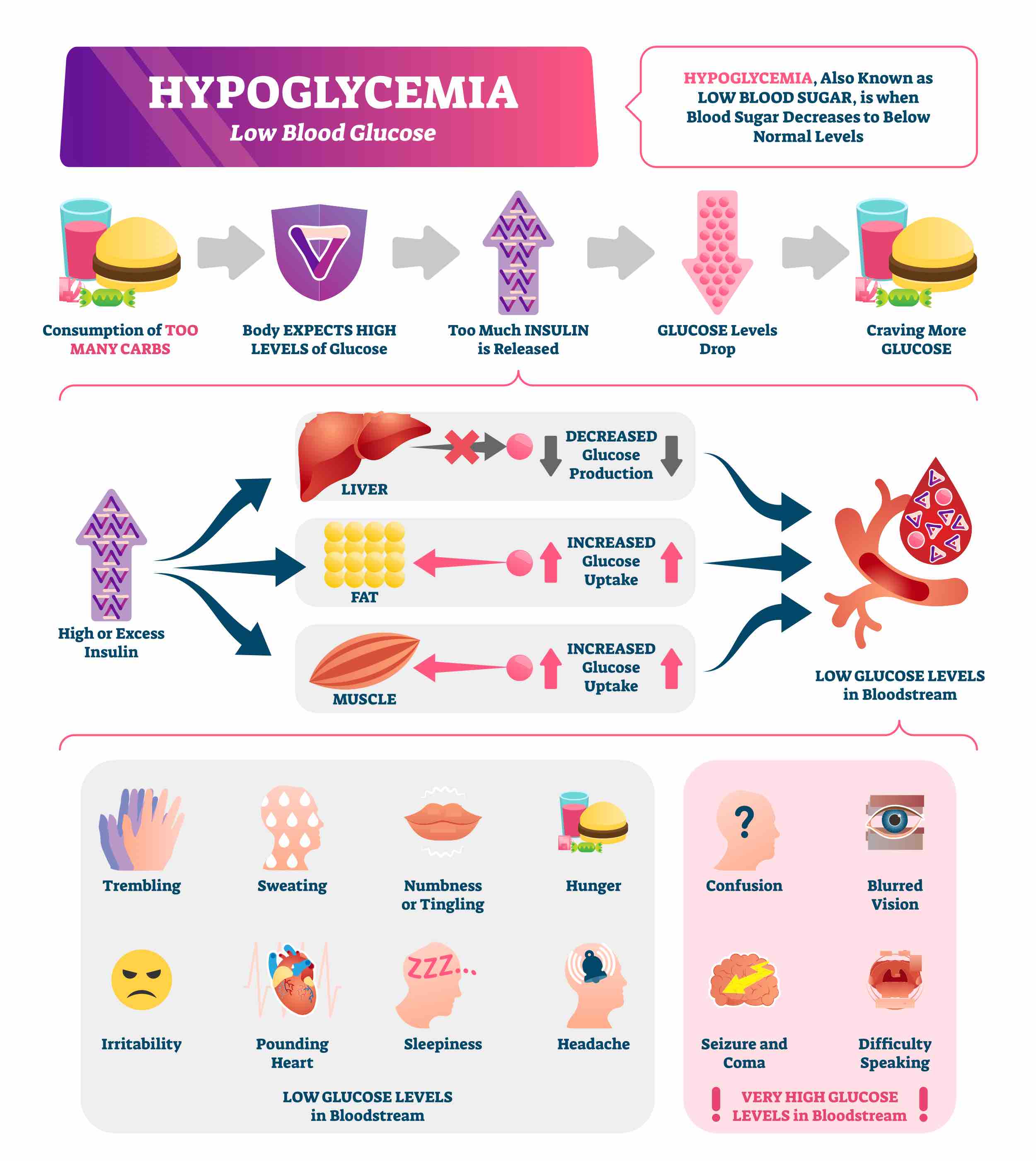 Hypoglycemia vector illustration. Labeled low sugar level medical scheme. Chronic diabetes from high carbs consumption and obesity. Excess bloodstream insulin educational symptoms and causes scheme By VectorMine - QF - 03