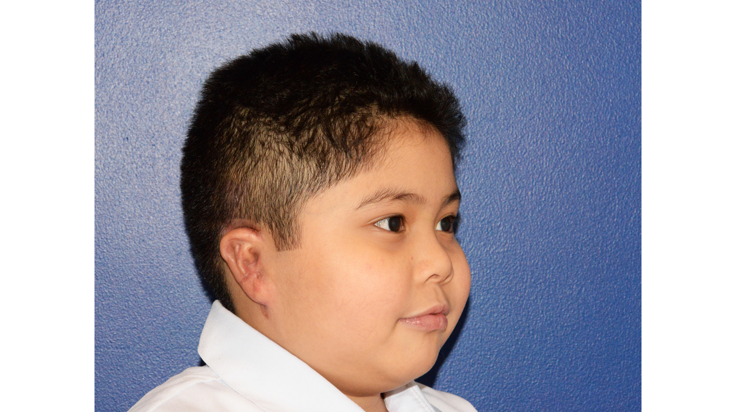 SIdra-Craniofacial-01