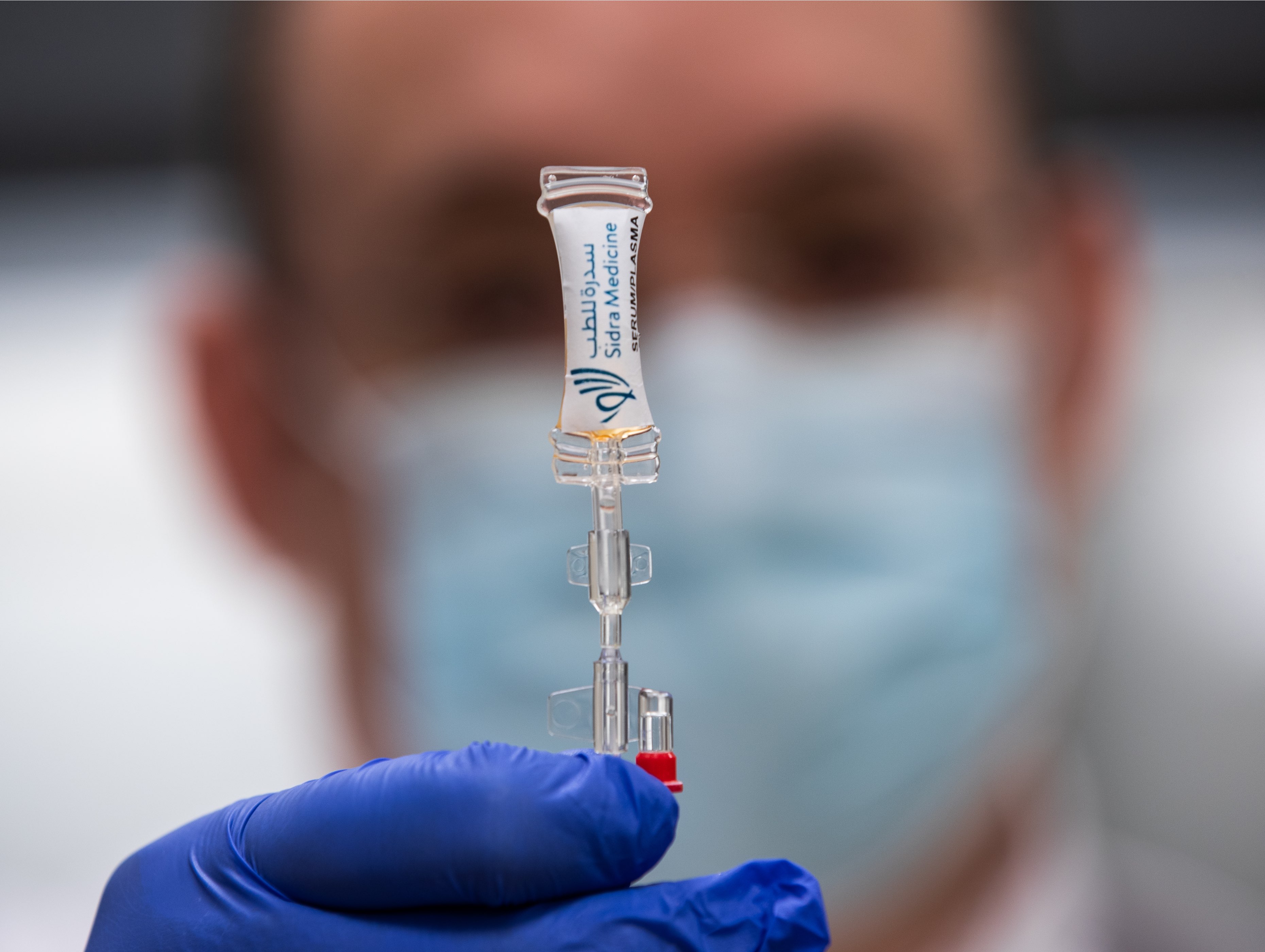 A first in Qatar: QF’s Sidra Medicine produces eye drops to treat 10-month-old girl with ultra-rare disease 