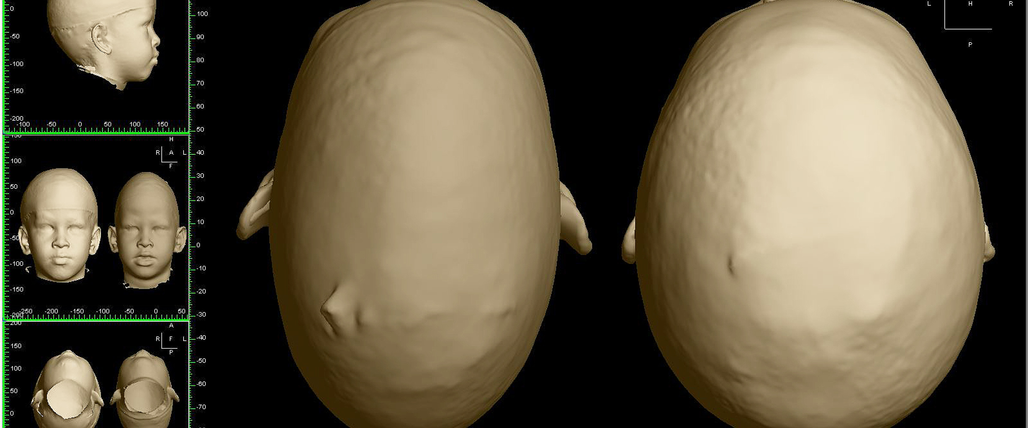 Reconstructing childrens’ lives using plastic surgery 