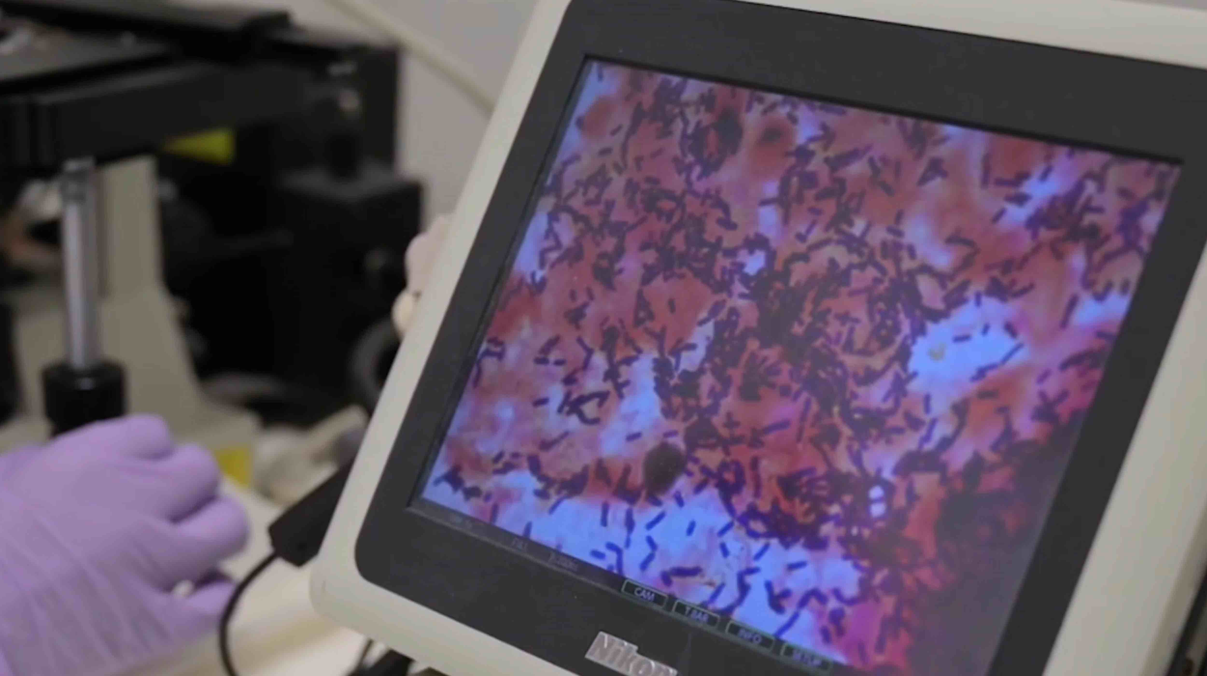 Time for one size fits all to become history in healthcare industry, precision medicine experts say in QF-backed Al Jazeera documentary - QF - 01