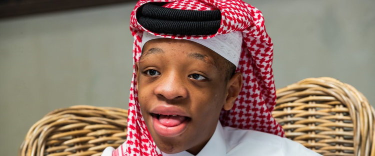 QF student’s mother narrates her experience of raising a son with an extremely rare condition 