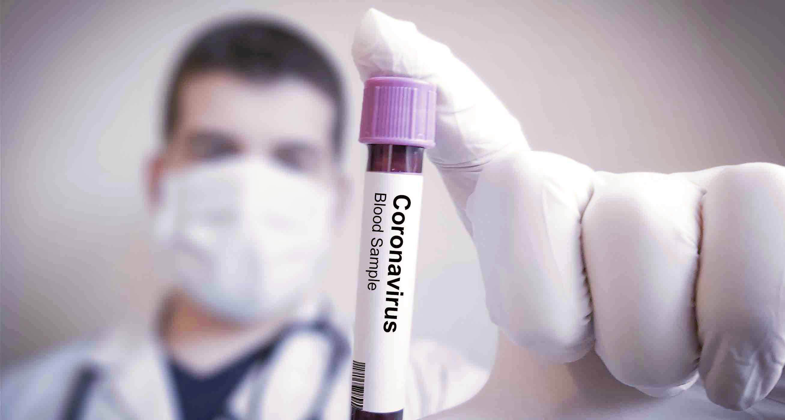 Coronavirus Psychosocial Impact - 02