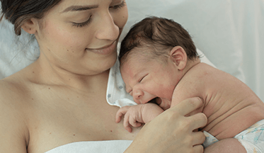 Conoce todo sobre la costra láctea de tu bebé