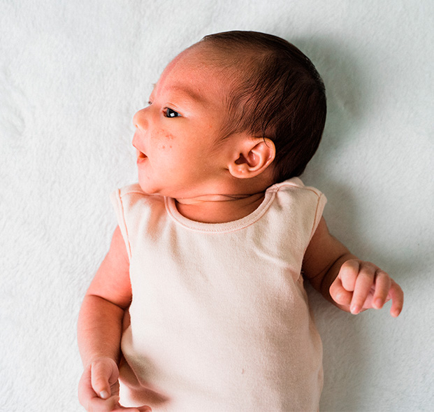 Mancha-blanca-en-la-piel-de-mi-bebe-desktop