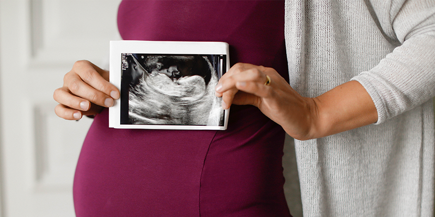 Ecografías durante el embarazo principal