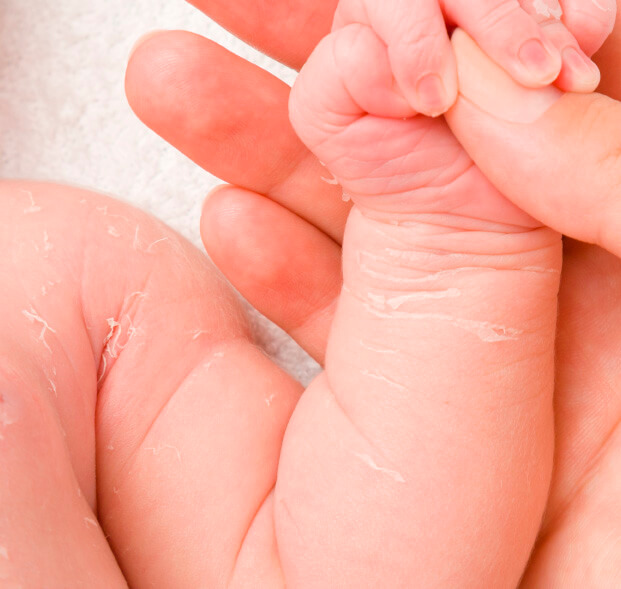 piel-reseca-en-bebes-desktop