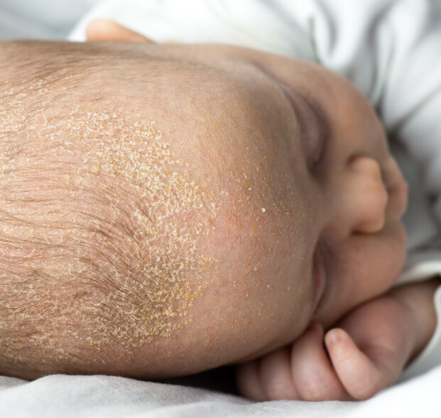 cuidados-para-la-piel-del-recien-nacido-desktop