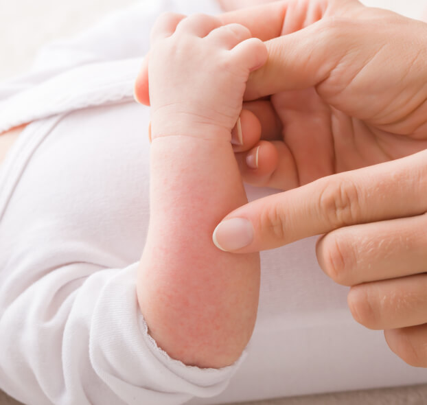 tipos-de-granos-o-sarpullidos-en-la-ouel-del-bebe-desktop