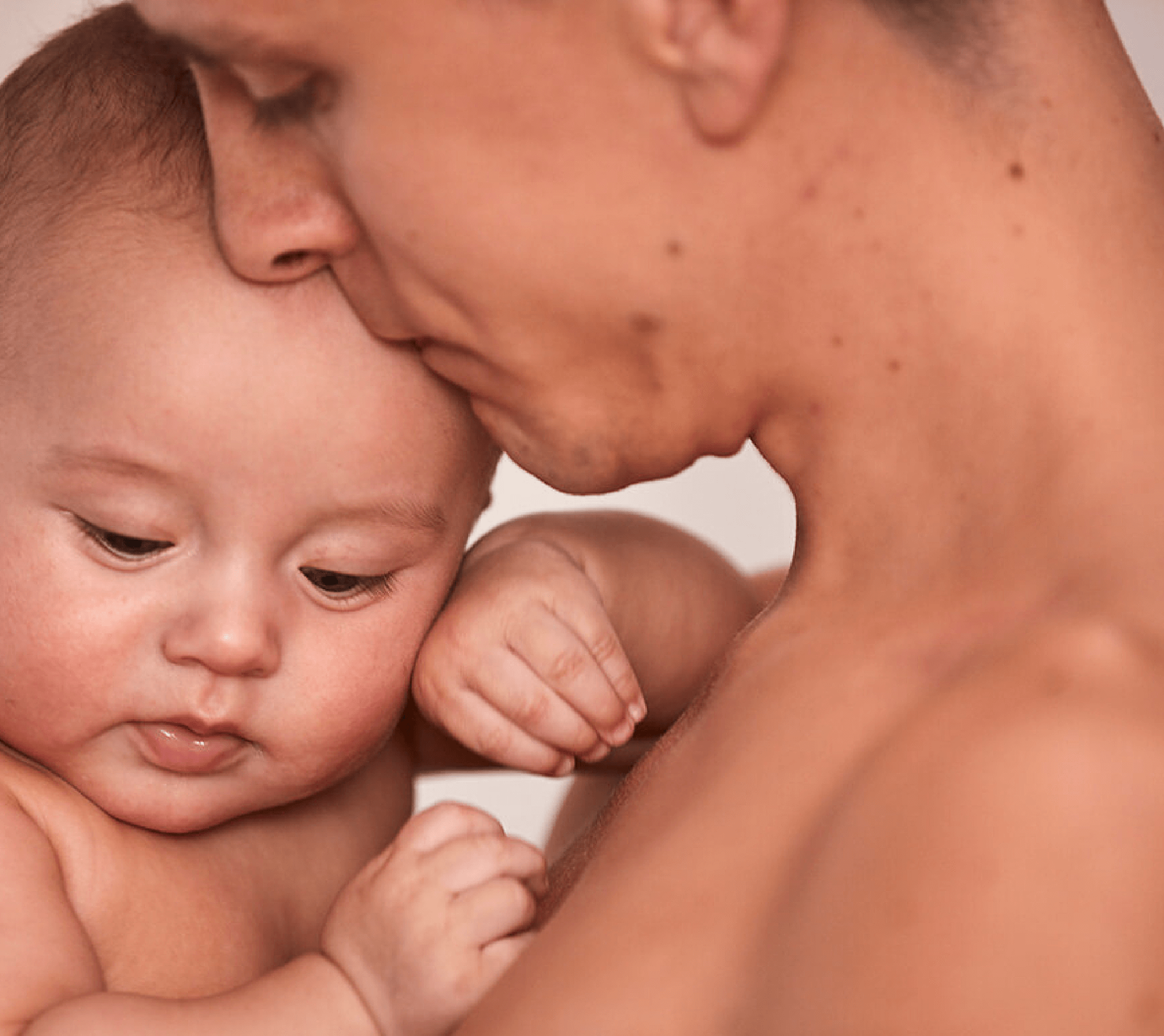 Costra láctea en bebés: preguntas y respuestas